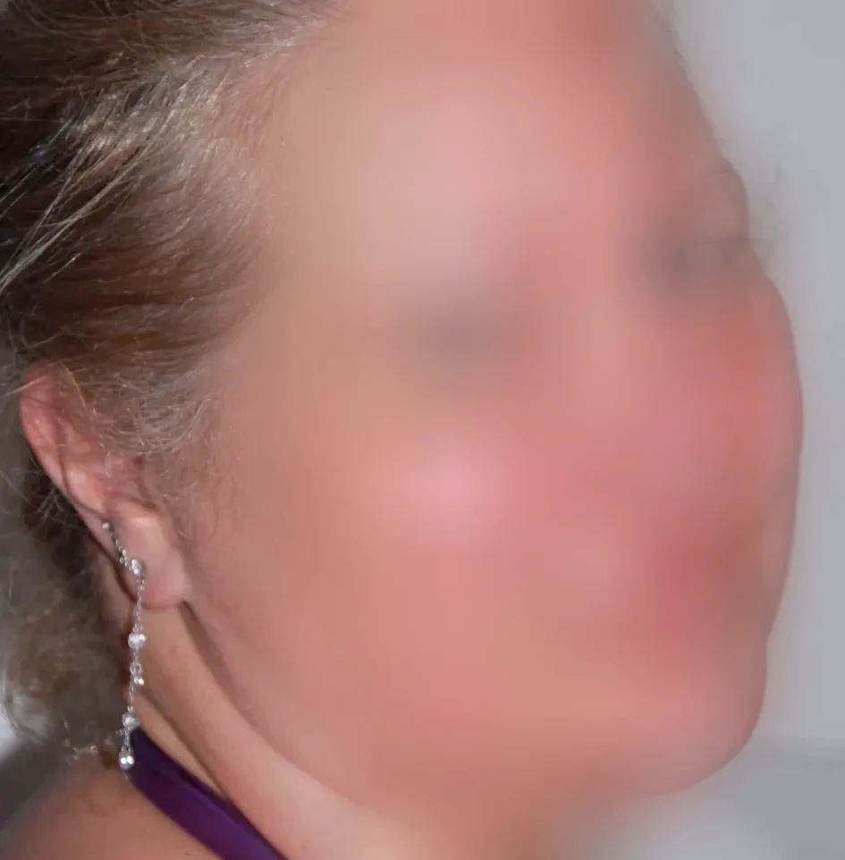 Signe, 28
